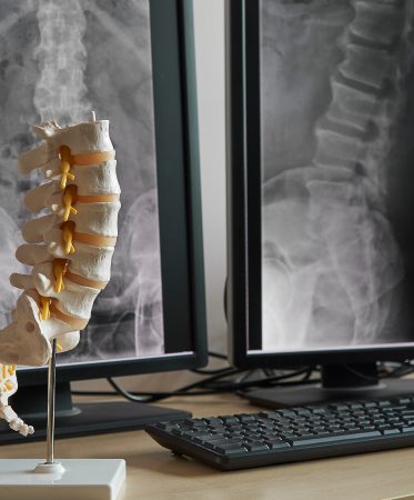 Imagen de columna modelo de mesa
