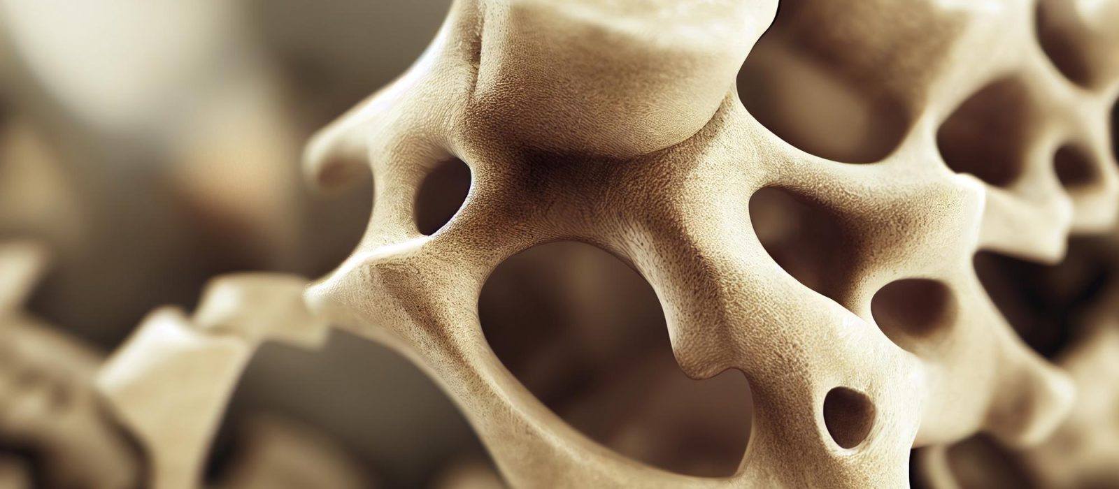 Hueso bajo los efectos de la osteoporosis