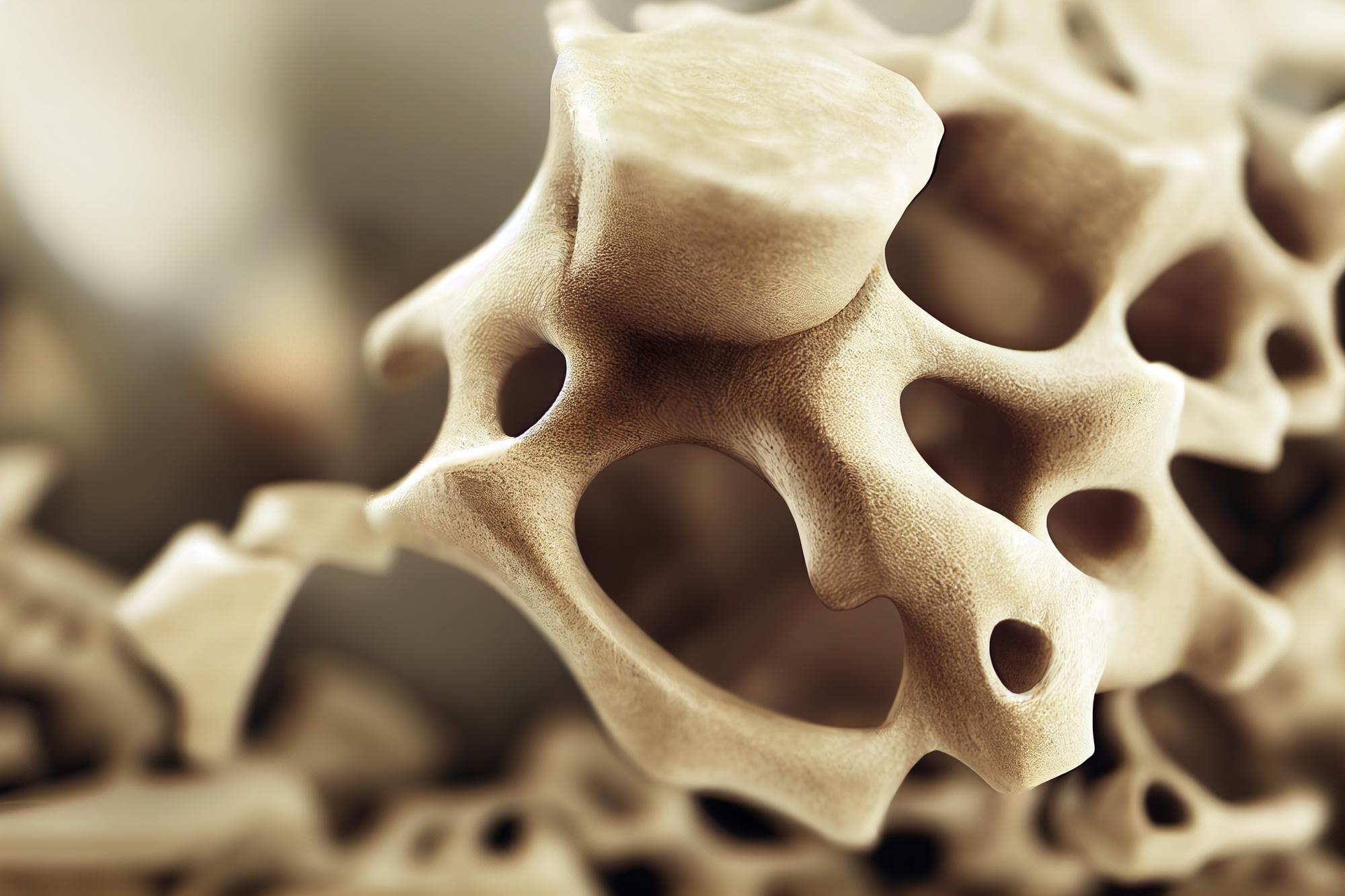 sapcv_Noticias-2023-01-23_Osteoporosis