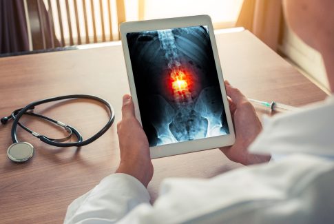 Doctor sosteniendo una tableta digital con un radiografia de la columna.