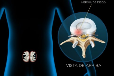 B2b Cirugia minimamente invasiva