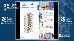congreso2024_d2-04b Uso de Guías 3D en Cirugía de Columna Dr. Luis Álvarez Galovich