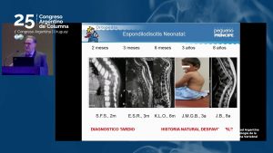 congreso2024_d3-08b Osteomielitis de Columna Neonatal: Dificultad, Diagnóstico, Secuelas y Tratamiento Dr. Luis Eduardo Munhoz da Rocha