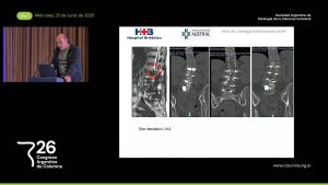 S3d. Presentación de Caso # 2. Obeid 2. ¿Cómo Manejo la Columna Lumbosacra? Dr. Ruy Lloyd