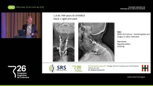 S5d. Presentación de Caso # 2. Cirugía Cérvico Torácica por Vía Posterior: Fístula de LCR. Dr. Matías Petracchi