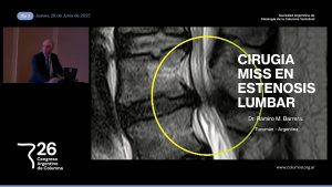 M1c. Técnica MISS para Estenosis de Conducto Lumbar. Dr. Ramiro Barrera